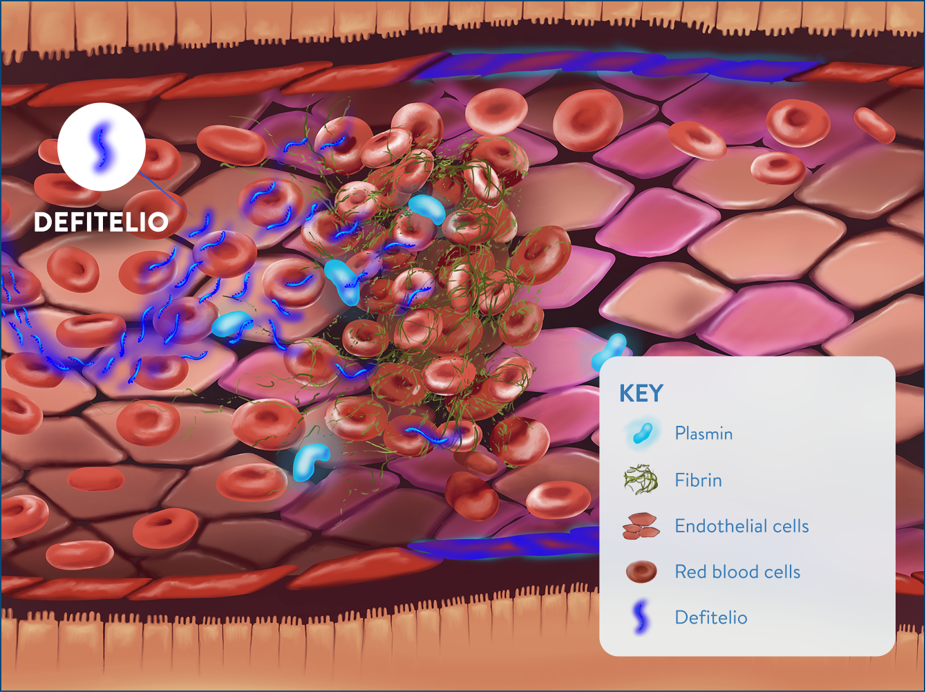 Protection and stabilization with Defitelio